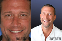 Before & After - Call (904) 273-3001 For More Information!